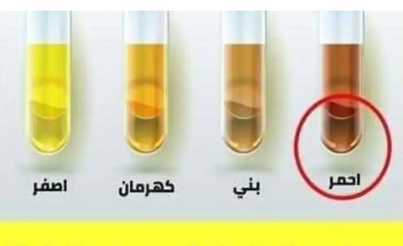 حديثة 